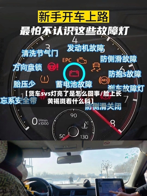【货车svs灯亮了是怎么回事/脸上长黄褐斑看什么科】-第1张图片